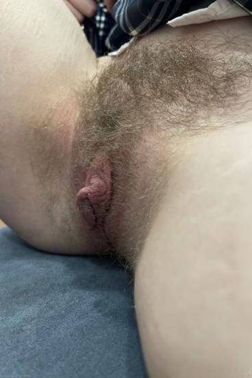金毛鲍鱼