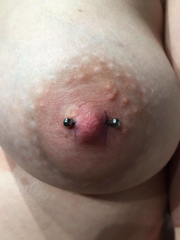 肉钉