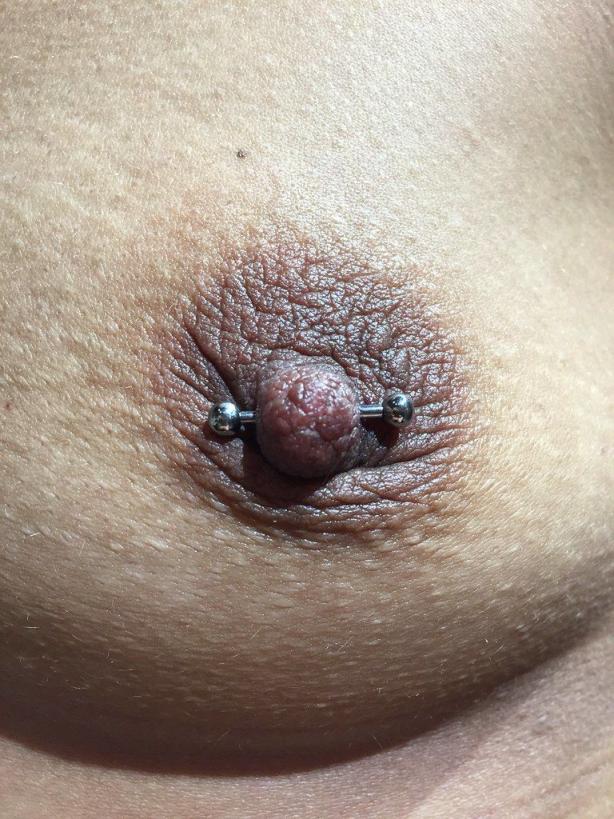 肉钉